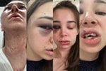«Ещё 20 секунд и она бы умерла», — узбекистанка заявила о жестоких избиениях ее дочери со стороны мужа