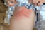Житель Ташобласти избил и пытался поджечь бывшую жену