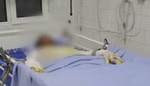 В Ташобласти подросток получил удар током, пытаясь сделать селфи на вагоне