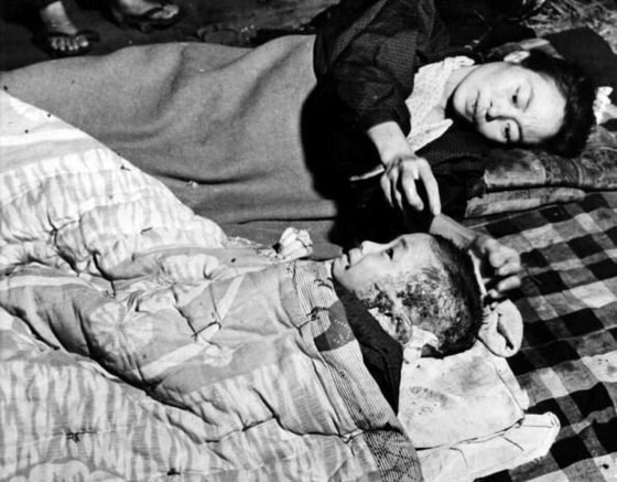 1945-yilda Xirosimaga atom bombasi tushishi oqibatida sodir bo'lgan portlashdan omon qolgan bolakay