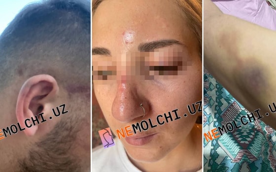 Фото:&nbsp;Nemolchi.uz