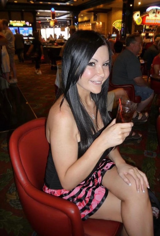 Джузеппина до операций/ Фото: Super.ru