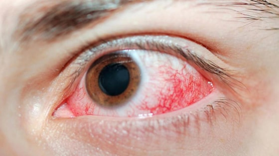 Фото: Ochkov.net