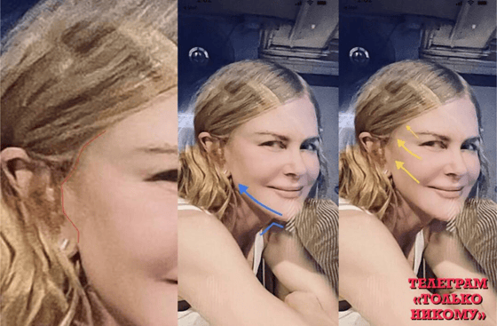 Фото: Telegram-канал Только Никому