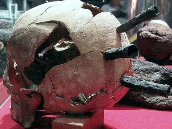 1361-yilda Shvetsiyaning Visbi shahri uchun olib borilgan jangda halok bo'lgan askarning bosh suyagi