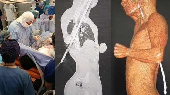 Фото: Пресс-служба Минздрава