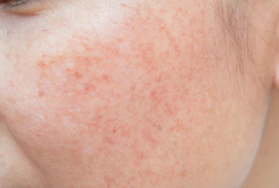 Ситуативное фото / Freepik