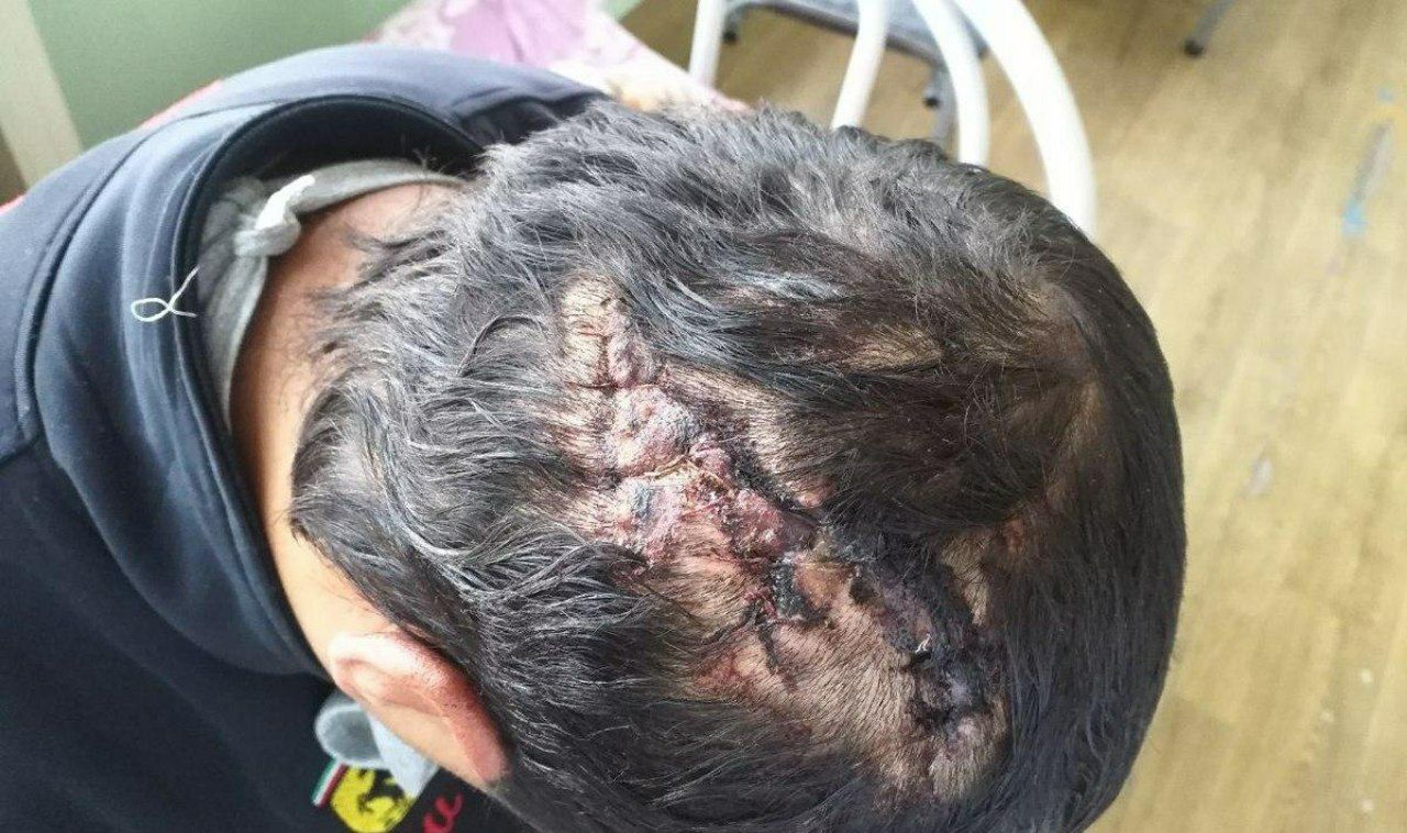 В Андижане 10 человек жестоко избили мужчину: сотрудники УВД игнорируют данный инцидент