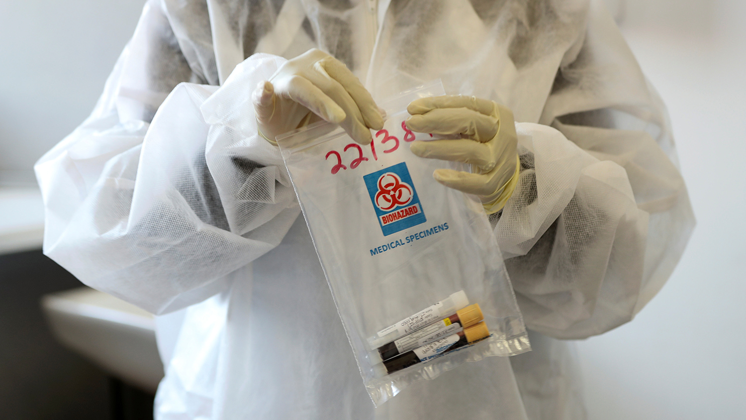 Эксперт опроверг один из опасных «народных» методов лечения коронавируса 