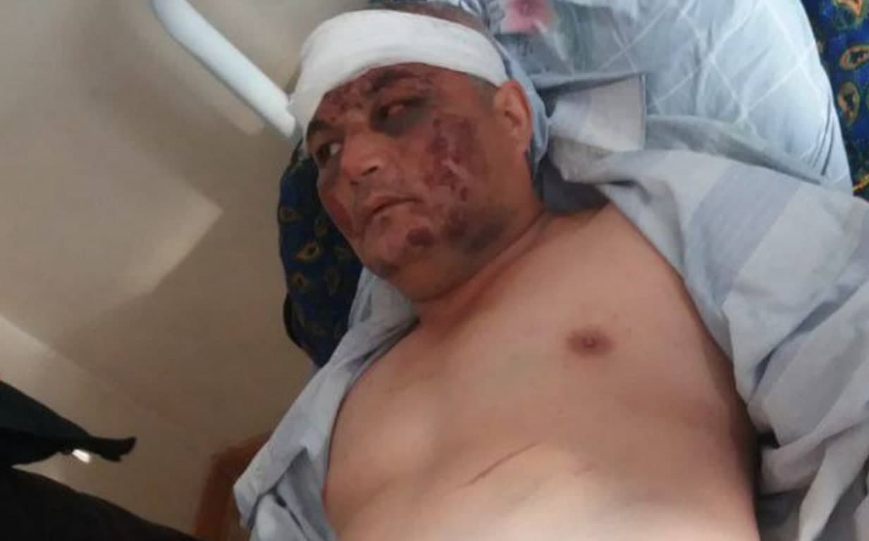 В Кашкадарье мужчине связали руки и ноги и жестоко избили