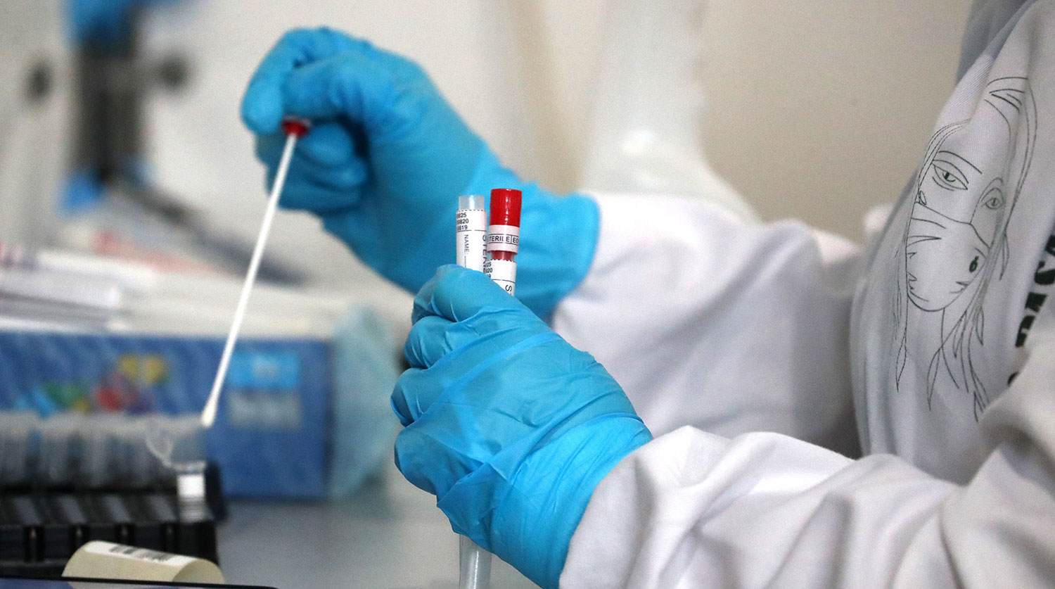 В Узбекистане за последние сутки коронавирус обнаружен у 118 человек