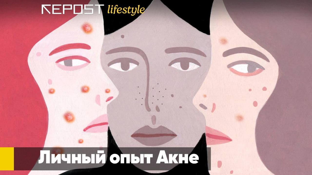 «Самая большая ошибка в лечении акне – самолечение»: личный опыт узбекистанок