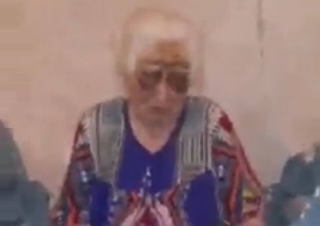 ГУВД прокомментировало видео пожилой женщины с множественными гематомами на лице, руках и ногах