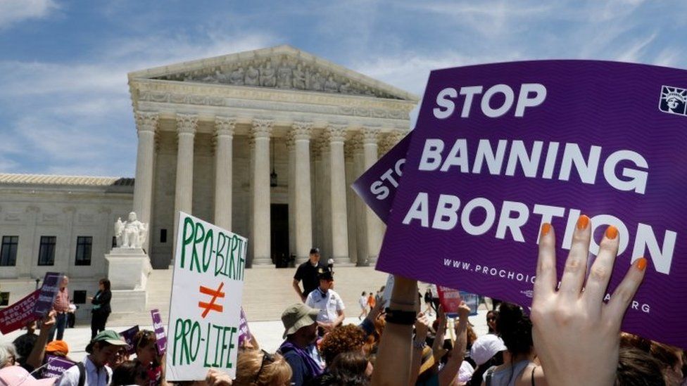 В Техасе запретят делать аборты сроком более шести недель