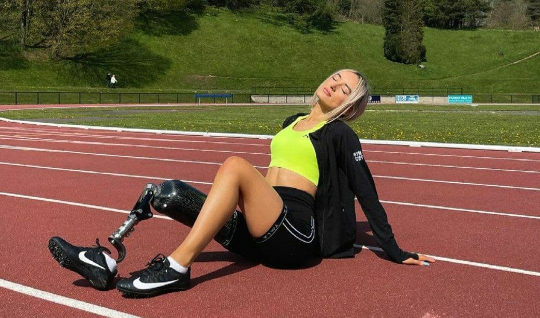 Девушка без ноги вышла в финал национального конкурса красоты