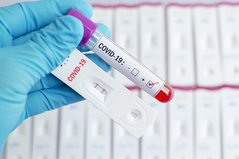 Специалист назвал срок иммунитета у переболевших COVID-19