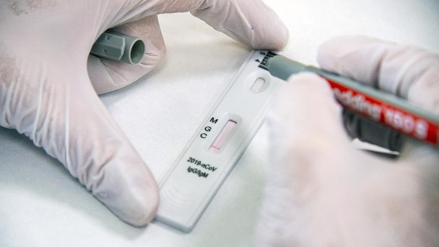 «Чепуха полнейшая и пустая трата денег»: эксперт раскритиковал сдачу тестов на антитела и призвал вакцинироваться