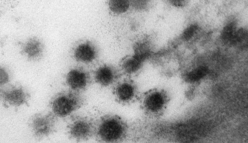 Узнайте, как выглядит дельта-штамм коронавируса — фото