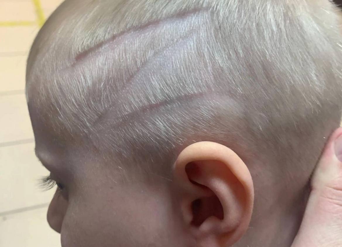 В России у ребенка без разрешения выбрили на голове букву Z – символ российского вторжения в Украину