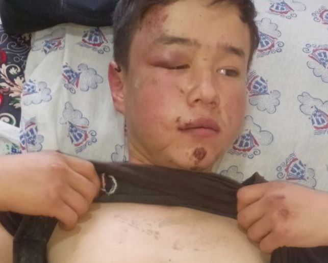 СМИ: В Кашкадарье депутат избил школьника из-за свидания с внучкой