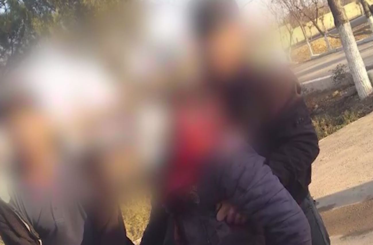 В Кашкадарье мужчины жестоко избили подростка: он может остаться инвалидом
