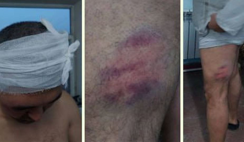 В Андижане избили водителя, возмутившегося пропусками без очереди на газовой заправке