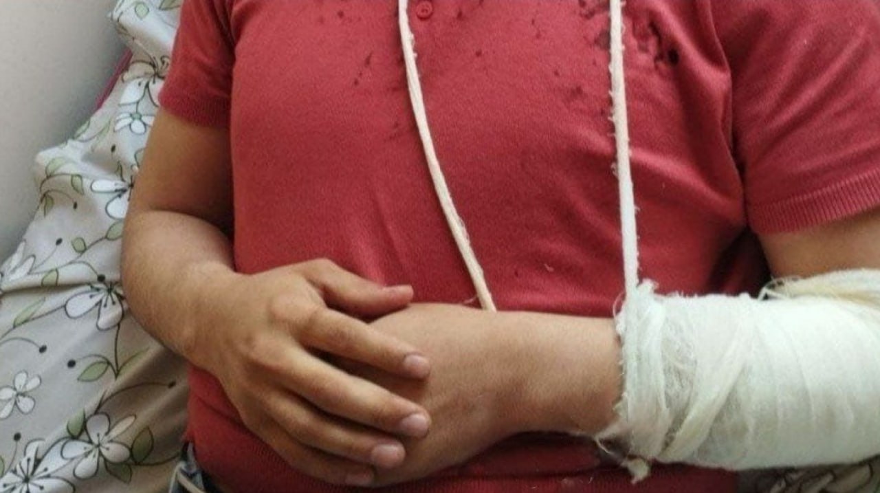 В Андижане толпа мужчин избила врача, оказавшего помощь пациентке 