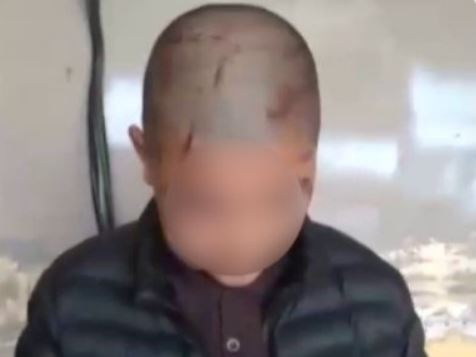 В Ургенче мужчина жестоко избил 14-летнего сына