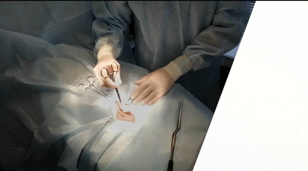 Посмотрите, как проходит операция по протезированию яичка – видео