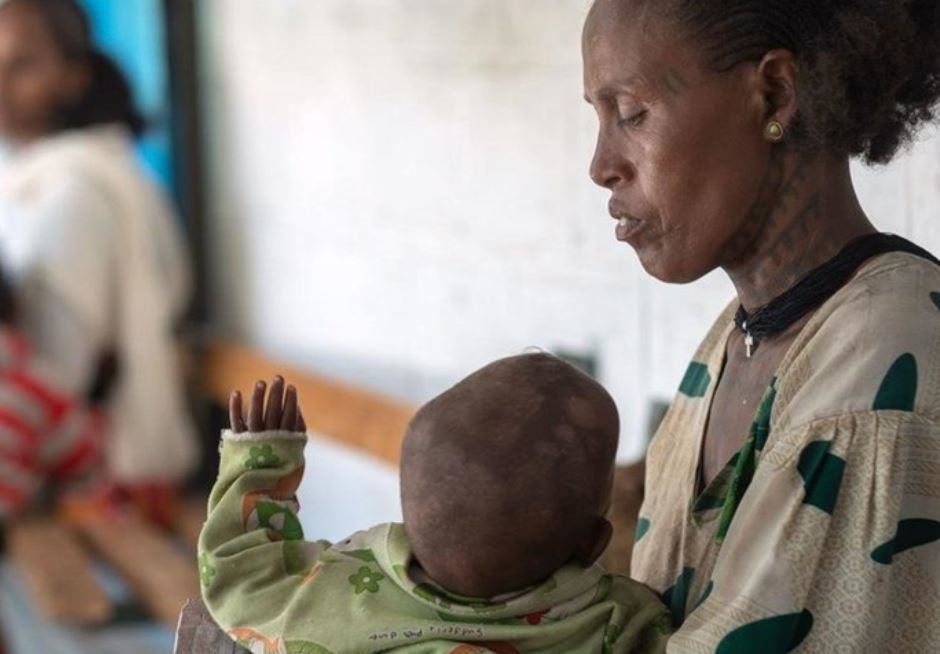 ВОЗ: Около 45 млн детей по всему миру страдают от истощения