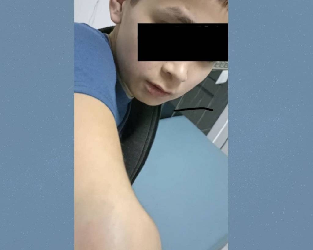 В ташкентском детдоме сотрудник систематически избивал своего воспитанника