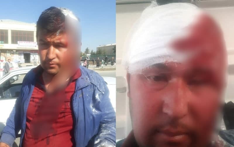В Шахрисабзе хулиганы жестоко избили 33-летнего гражданина на глазах у его родителей
