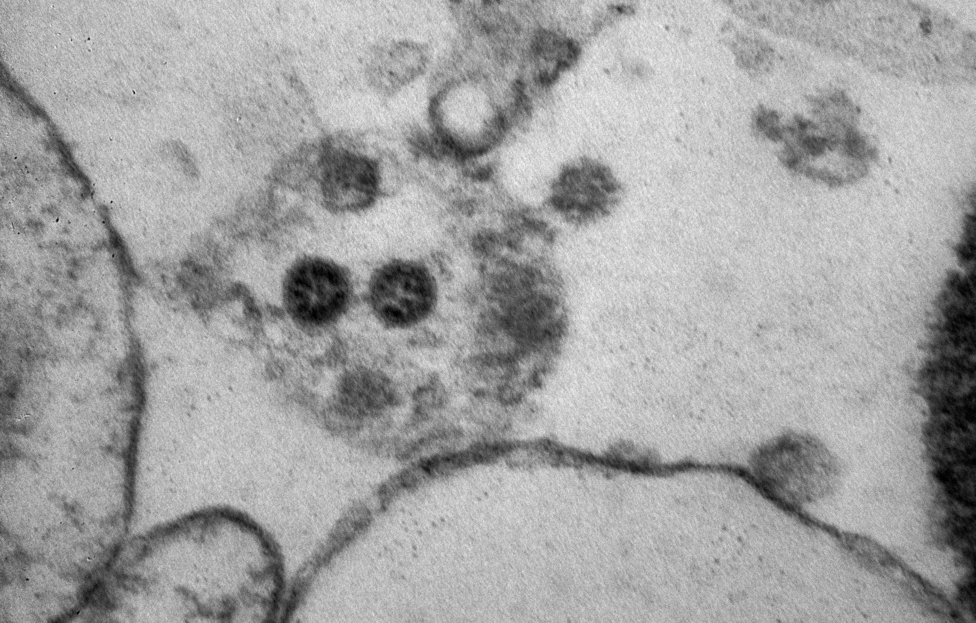 США захвачен омикрон-штаммом коронавируса — подробности