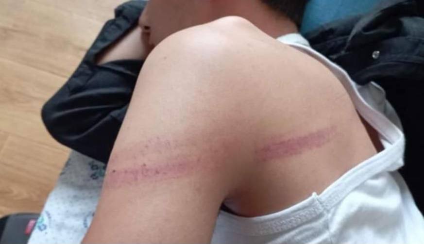 В Андижане преподаватель избил ученика линейкой — фото