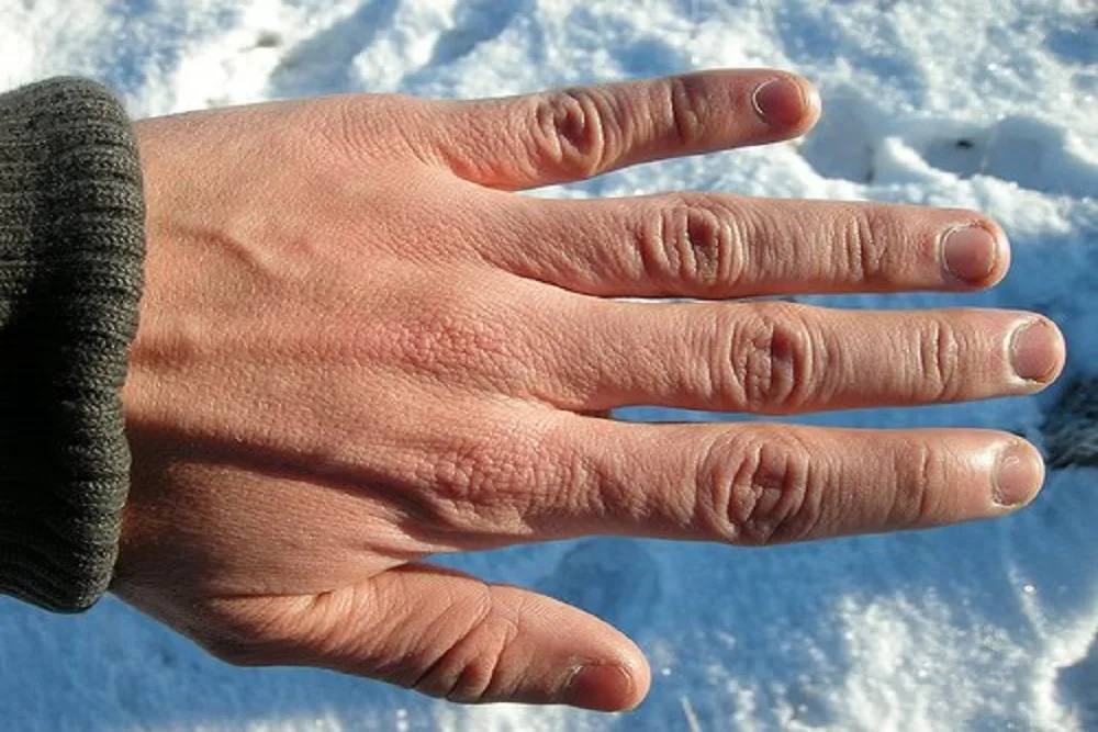 Ученые создали крем, который не дает рукам замерзнуть