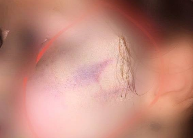 В Ташобласти воспитательница частного детсада избила двухлетнюю девочку