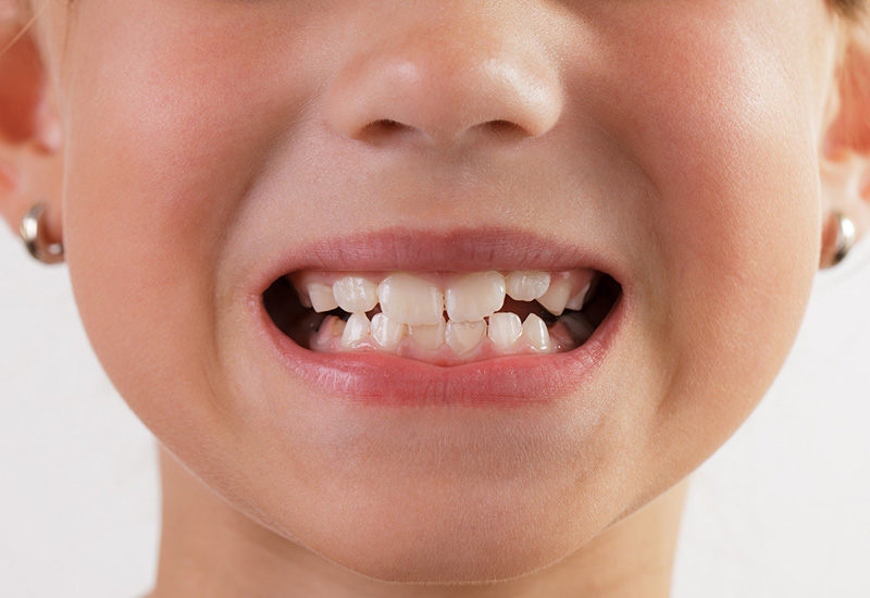 Стоматолог из Узбекистана рассказал, зачем нужно ставить зубные имплантаты