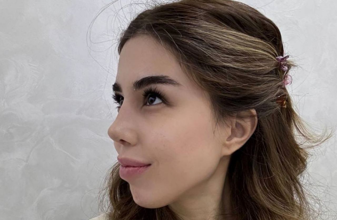 Блогер Диера Азимова похвасталась результатом после операции носа