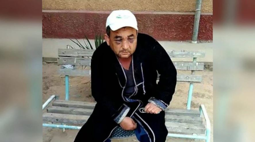 Житель Кашдарьинской области избил односельчанина: по заявлению пострадавшего, в его дом ворвалась группа людей во главе с депутатом