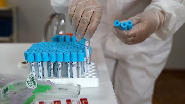В Узбекистане выявили 173 новых случая заражения коронавирусом