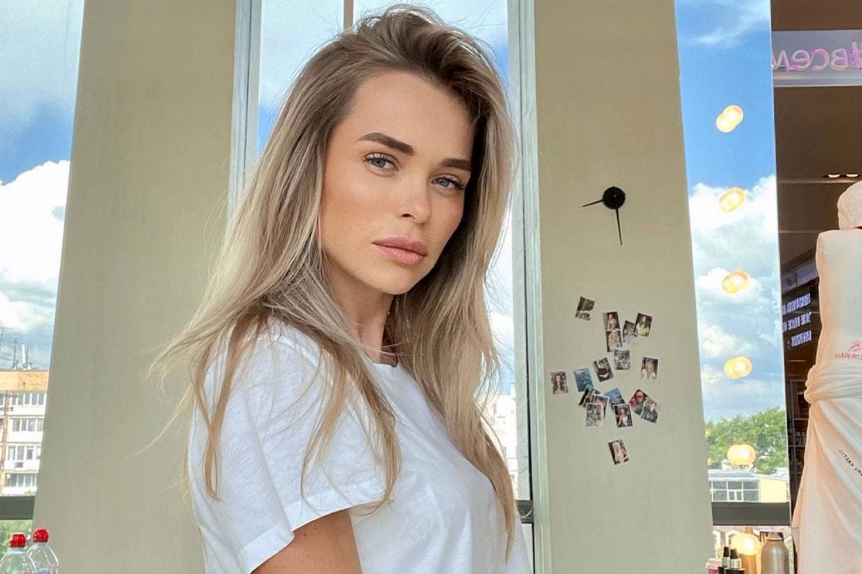 Актрису Анну Хилькевич обвинили в злоупотреблении филлерами для губ