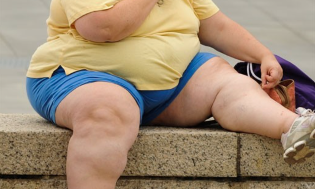 В чем основная причина ожирения?