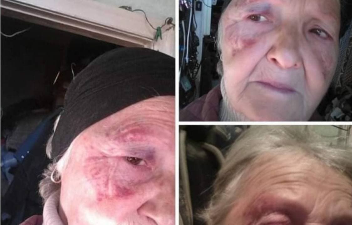 В Ташобласти покушались на жизнь пожилой женщины за содержание собак в доме