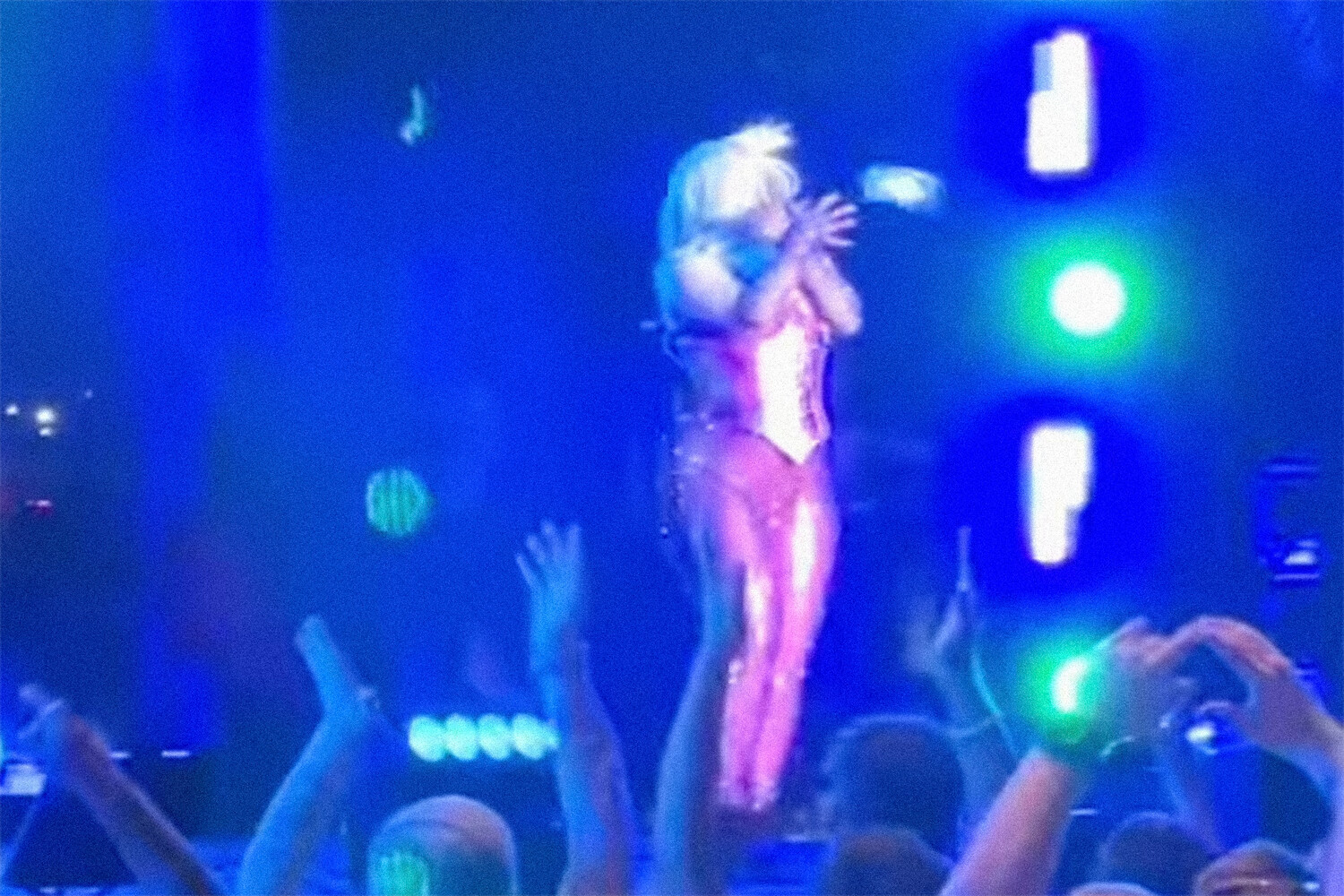 Поклонник рассек Биби Рексе лоб, кинув в нее телефон во время концерта