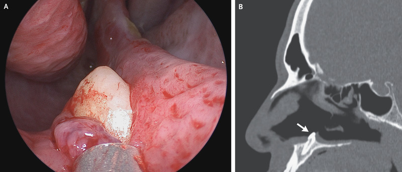 Cнимки, которые были сделаны во время обследования пациента. Фото: nejm.org