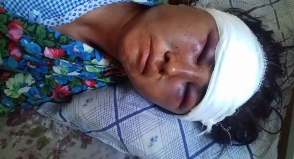 В Самаркандской области муж избил молодую жену до полусмерти