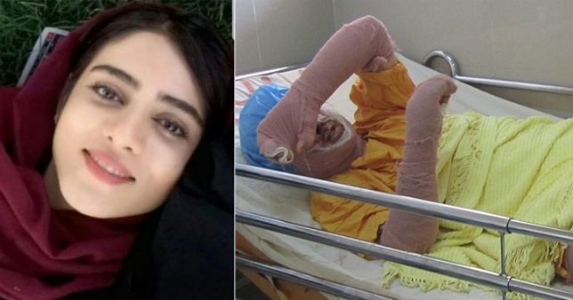 Иранская футбольная болельщица скончалась в результате самоподжога  в знак протеста 