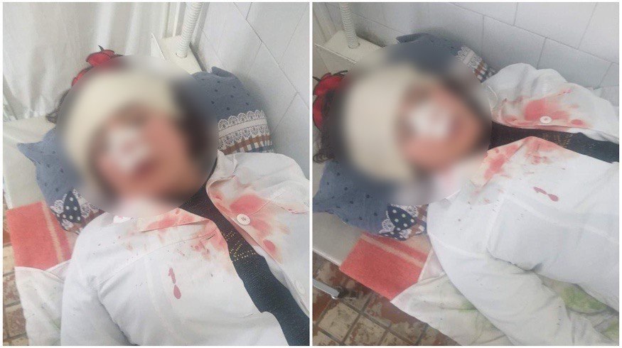 В Фергане пациентка вместе с матерью напали на медсестру и избили её до сотрясения мозга