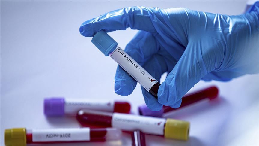 Озвучены новые подробности о первой скончавшейся узбекистанке, которая заразилась коронавирусом