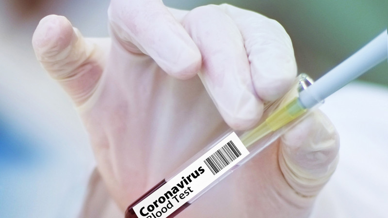 Найдено блокирующее размножение коронавируса лекарство